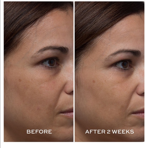 Elemis - Picture 2 of 5